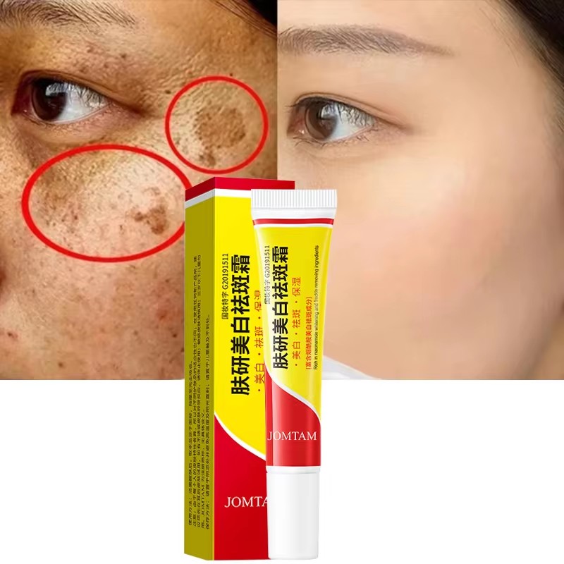 Skincare Glad2Glow - Отбеливающий крем от веснушек, осветляющий крем