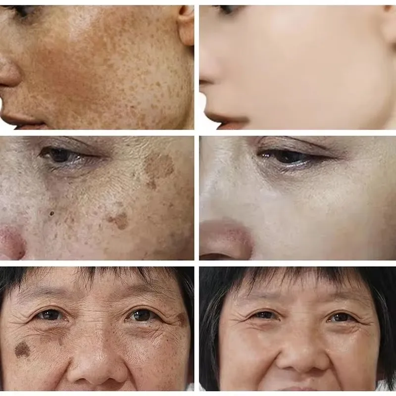 Отбеливающий крем от веснушек, – обзор и цена Skincare Glad2Glow