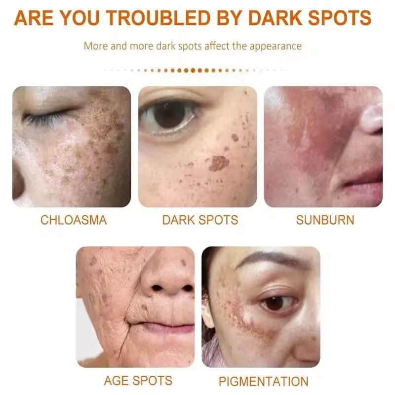 Отбеливающий крем от веснушек, – обзор и цена Skincare Glad2Glow